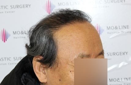 치료후기 이미지